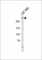 ABCA2 Antibody (Center)